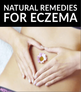 natural remedies for eczema